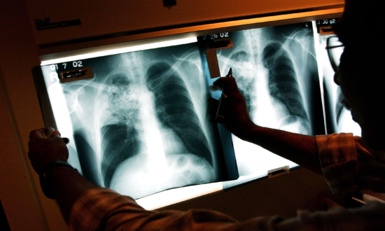 Deadly Lung Disease Cases Surge to 10-Year High, Children Most Affected: CDC