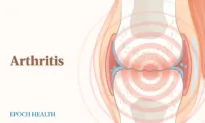 Arthritis: Most Common Cause of Disability in the US, 8 Natural Supplements for Relief
