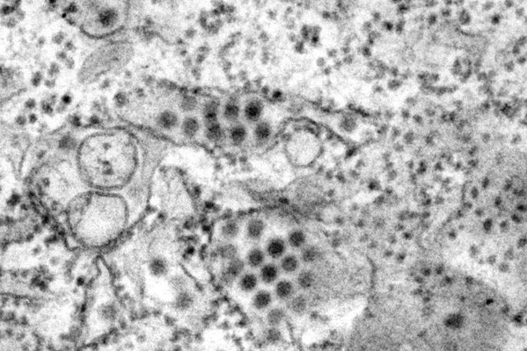 This transmission electron microscopic image depicts a number of round dengue virus particles that were revealed in this tissue specimen. (Frederick Murphy/U.S. Centers for Disease Control and Prevention)