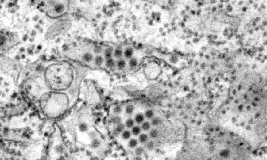 This transmission electron microscopic image depicts a number of round dengue virus particles that were revealed in this tissue specimen. (Frederick Murphy/U.S. Centers for Disease Control and Prevention)