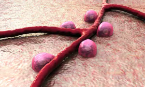 Rise in Type 1 Diabetes Among Young People Linked to COVID-19: How to Prevent Autoimmune Diseases