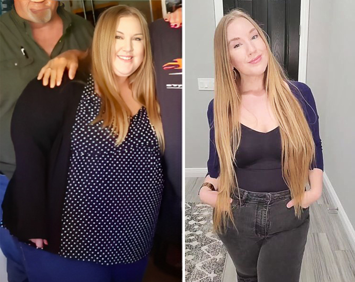 (Left) Ms. Bishop before she began her weight loss journey, (Right) Ms. Bishop after she began her weight loss journey.