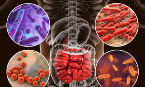 How a Psychobiotic Diet Boosts Mental Health