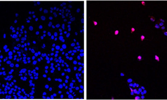 US Scientists Develop New ‘Cancer-Stopping Pill’ That Can ‘Annihilate’ Tumors, Leave Healthy Cells Unharmed