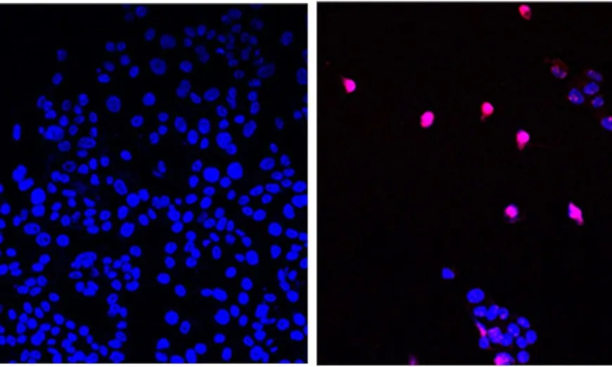 The City of Hope-developed small molecule AOH1996 targets a cancerous variant of the protein PCNA. In its mutated form, PCNA is critical in DNA replication and repair of all expanding tumors. Image shows untreated cancer cells (L) and cancer cells treated with AOH1996 (R) undergoing programmed cell death (violet). (Courtesy of City of Hope)