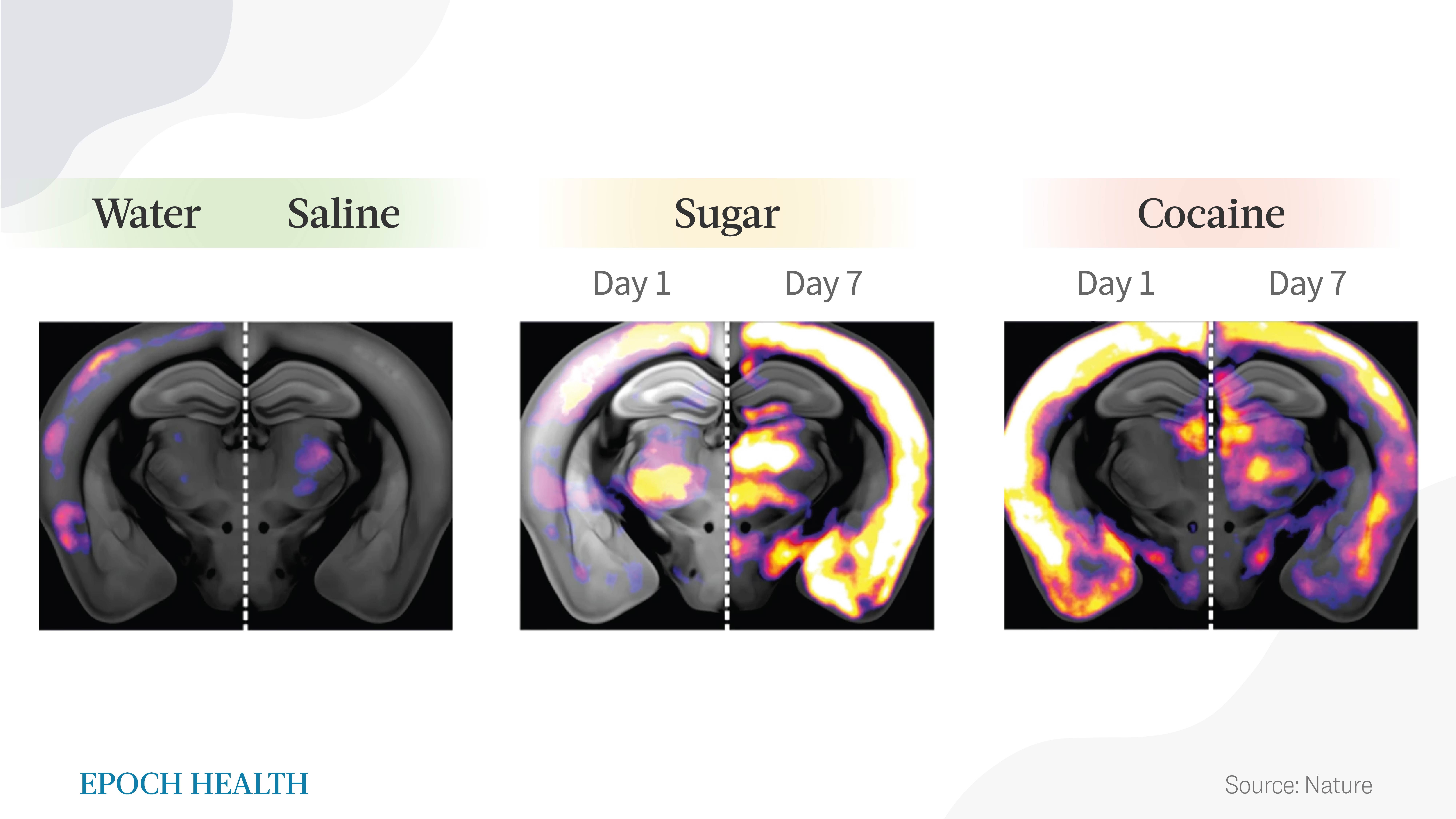 Activation of brain neurons in specific regions upon sucrose and cocaine administration. (The Epoch Times)