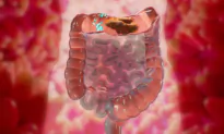 Study Links Constipation to Cognitive Decline
