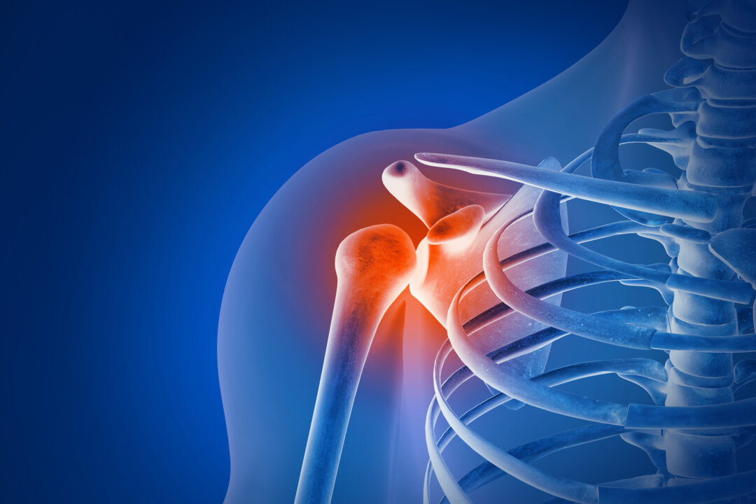 Chronic Shoulder Pain: Often Caused by Muscular Imbalances, 5 Exercises ...