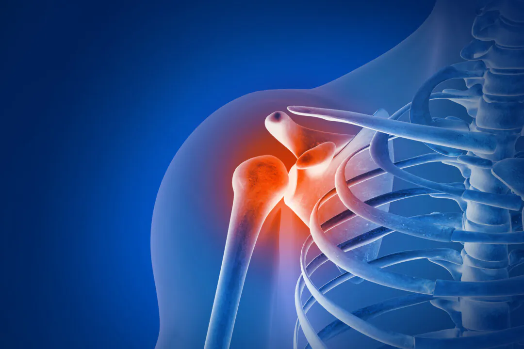 Chronic Shoulder Pain: Often Caused by Muscular Imbalances, 5 Exercises to Restore Movement, Strength, and Balance
