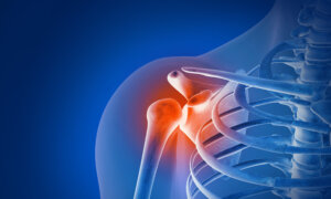 Chronic Shoulder Pain: Often Caused by Muscular Imbalances, 5 Exercises to Restore Movement, Strength, and Balance