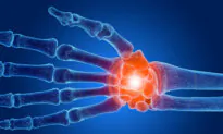 Chronic Wrist Pain: Can Last for Years, a Therapist’s Top Exercises to Relieve