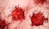 Researchers Discover Concerning Cancer Trend in Young Adults