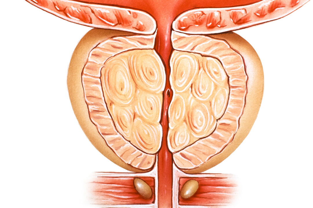 (Medical Art Inc/Shutterstock)