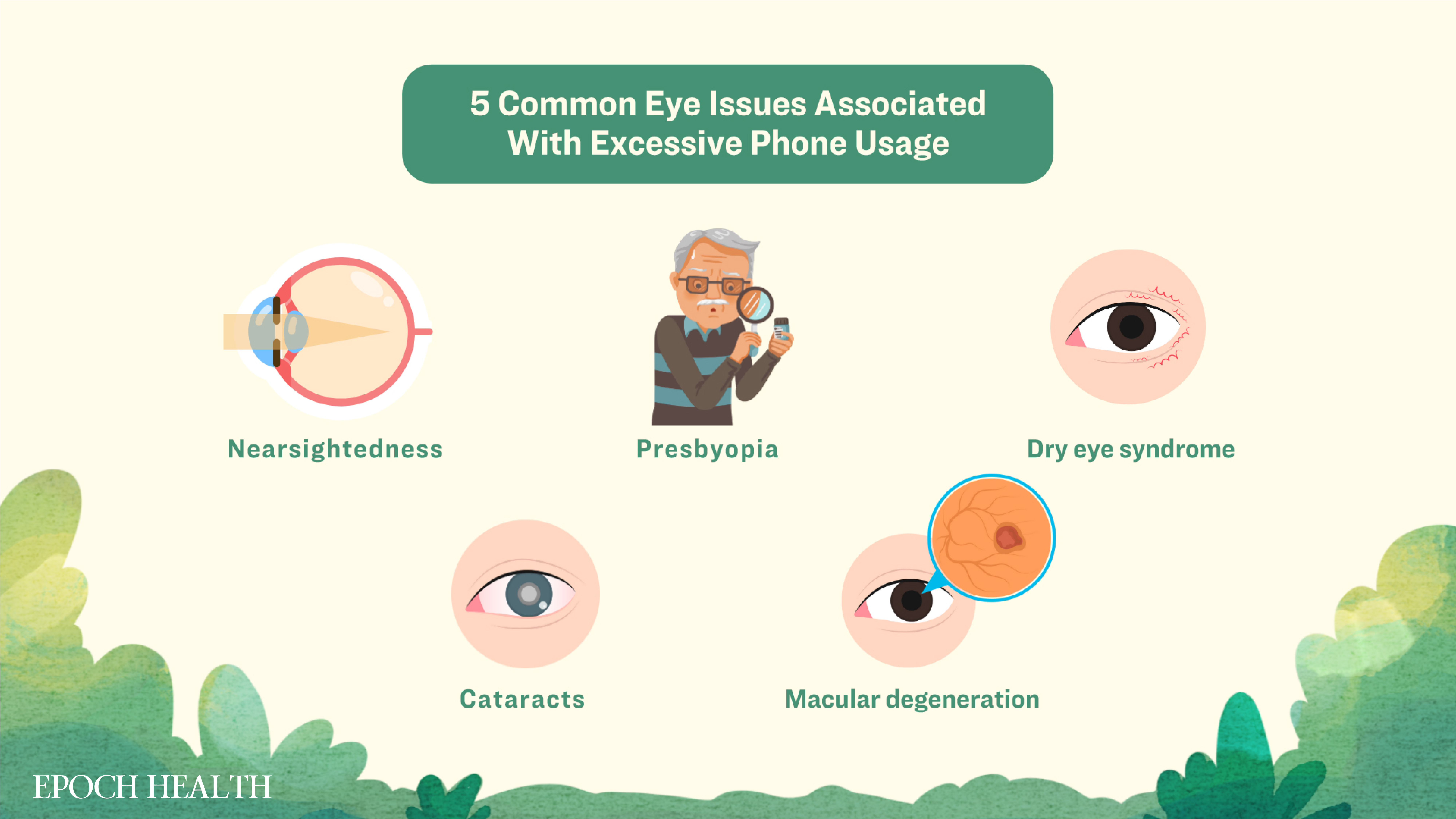 Five common eye issues associated with excessive mobile phone usage: nearsightedness, presbyopia, dry eye syndrome, cataracts, and macular degeneration.