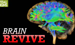 How Alzheimer’s Could Be Treated With Functional MRI and Ultrasound | Feat. Dr. Sheldon Jordan