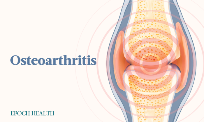 2 Main Causes of Osteoarthritis