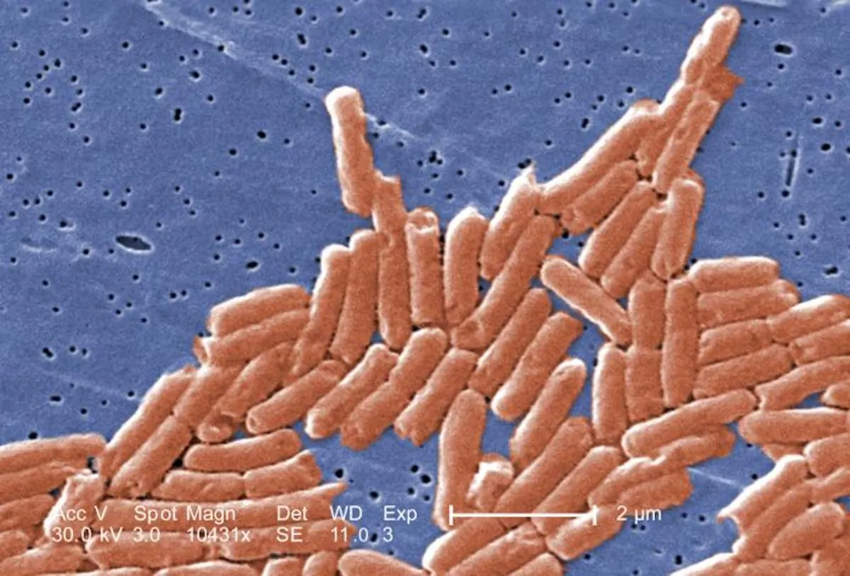 A digitally colorized electron microscope image of a grouping of Gram-negative bacilli, or rod-shaped, Salmonella sp. bacteria. (Janice Haney Carr/CDC)