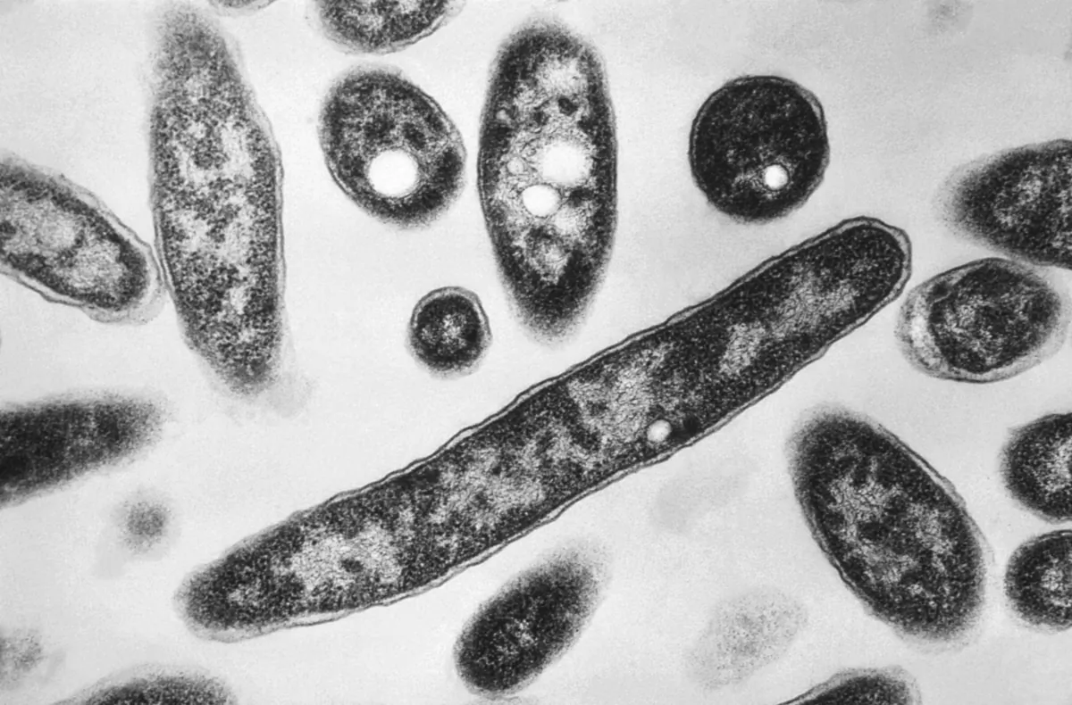 Legionella pneumophila bacteria thar are responsible for causing the pneumonic disease Legionnaires' disease, in a 1978 electron microscope image. (Francis Chandler/CDC via AP)