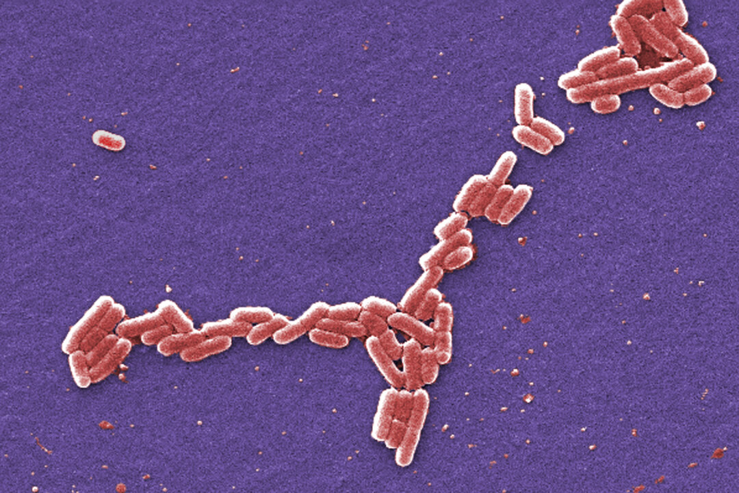E. coli bacteria of the O157:H7 strain that produces a powerful toxin which can cause illness in 2006. (Janice Haney Carr/CDC via AP)