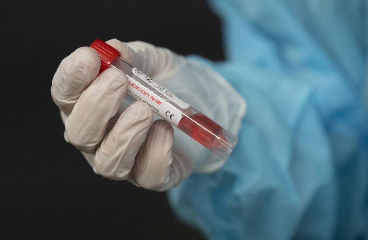 A nurse holds a vial containing a patient's test swab at the National Arts Centre Nov. 18, 2020, in Ottawa, Ont. (The Canadian Press/Adrian Wyld)