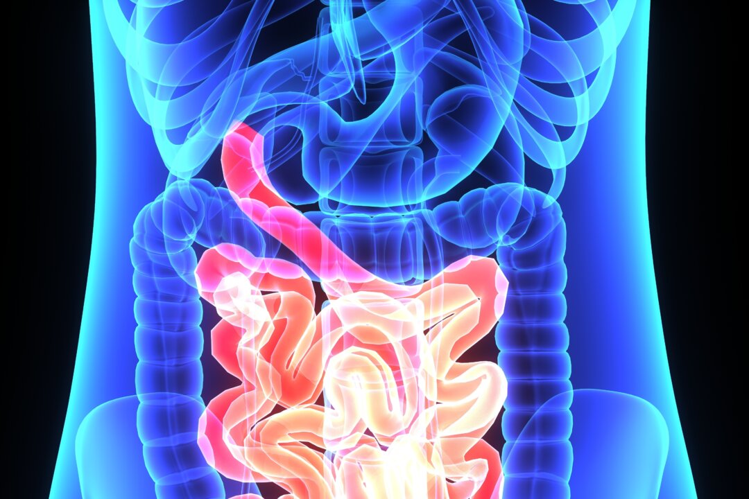 Not many people have L. reuteri bacteria in their gut anymore, which might explain the rise in small intestinal bacterial infections. (Shutterstock)