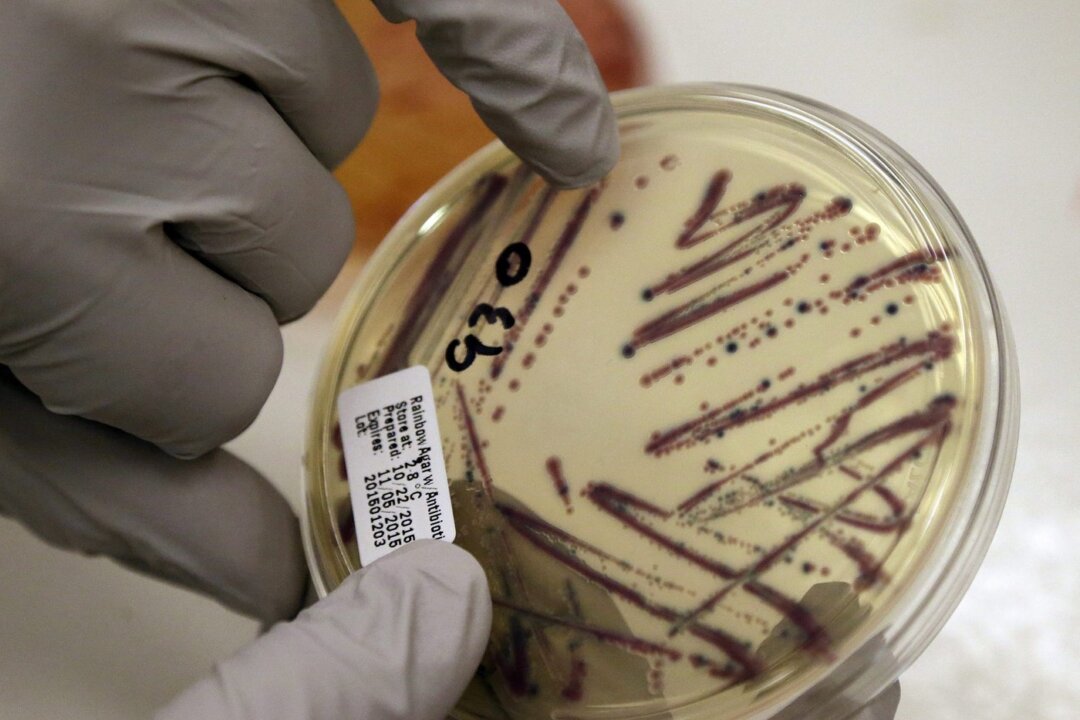 A microbiologist points out an isolated E. coli growth on an agar plate from a patient specimen at the Washington State Dept. of Health in Shoreline, Wash. on Nov. 3, 2015, (The Canadian Press/AP/Elaine Thompson)