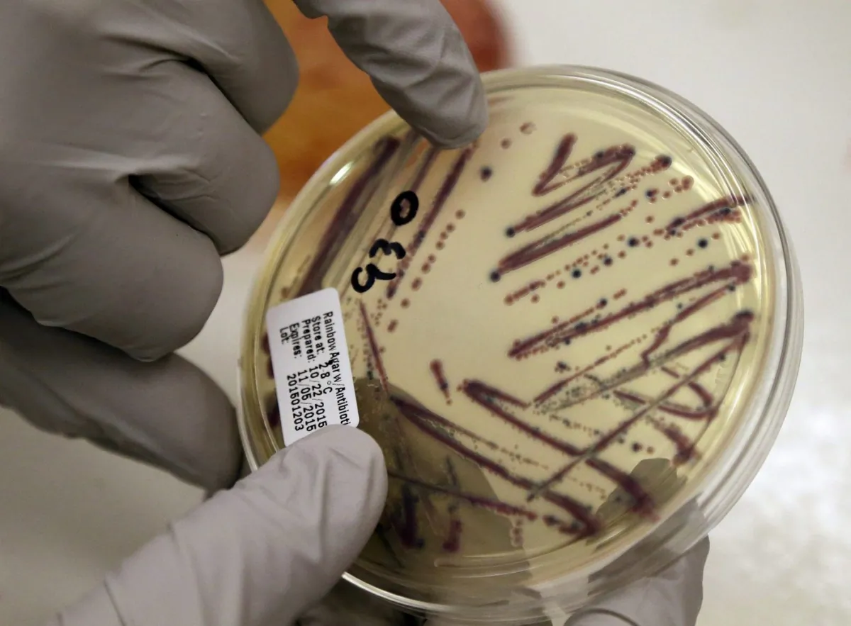 A microbiologist points out an isolated E. coli growth on an agar plate from a patient specimen at the Washington State Dept. of Health in Shoreline, Wash. on Nov. 3, 2015. (The Canadian Press/AP/Elaine Thompson)