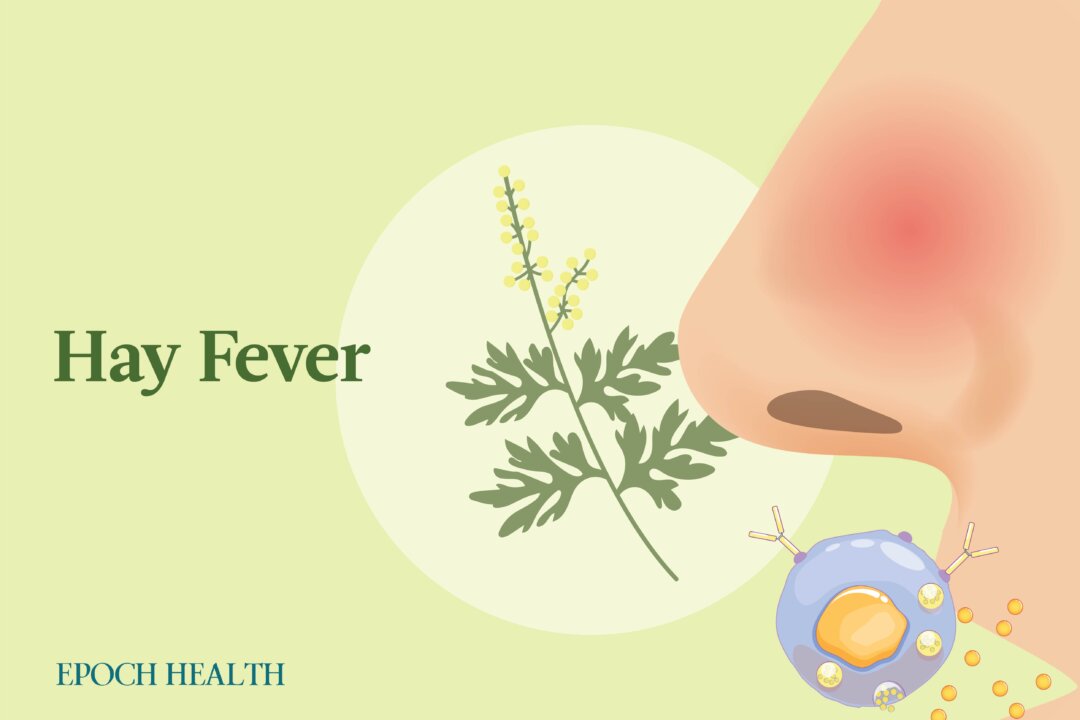 Hay fever affects about 1 in 5 people at some point. (Illustrations from Shutterstock / Designed by The Epoch Times)