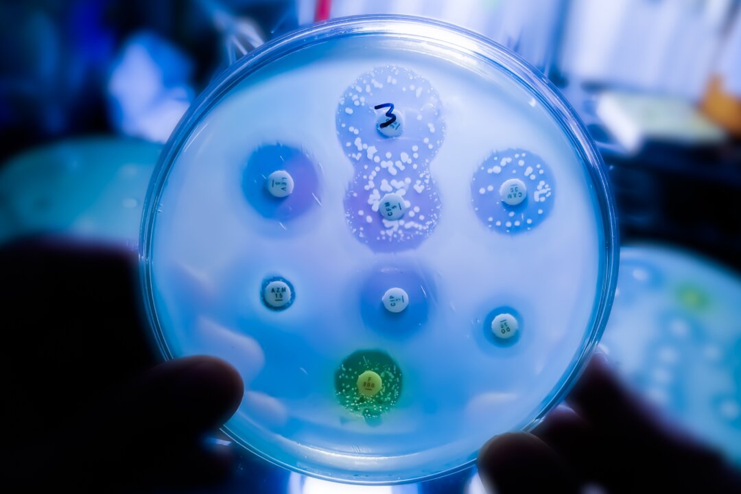 The technology used to identify bacterial strains and whether they'll respond to antibiotics is a century old. (Shutterstock)
