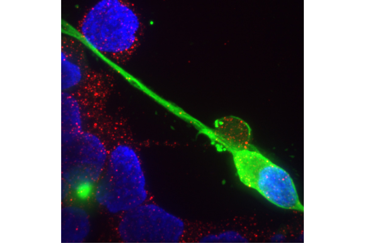 Sensory neurons infected with SARS-Cov-2, the virus that causes Covid-19. Credit Figure 2, Flamier, A., Bisht, P., Richards, A., Tomasello, D.L, Jaenisch, R., Human iPS cell-derived sensory neurons can be infected by SARS-CoV-2, ISCIENCE (2023), doi: https://doi.org/10.1016/j.isci.2023.107690