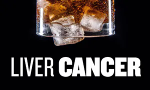 Study: Daily Soda Drinkers Have an 85–Percent–Higher Risk of Developing Liver Cancer