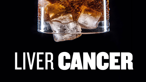 Study: Daily Soda Drinkers Have an 85 Percent Higher Risk of Developing Liver Cancer