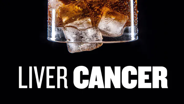 Study: Daily Soda Drinkers Have an 85–Percent–Higher Risk of Developing Liver Cancer