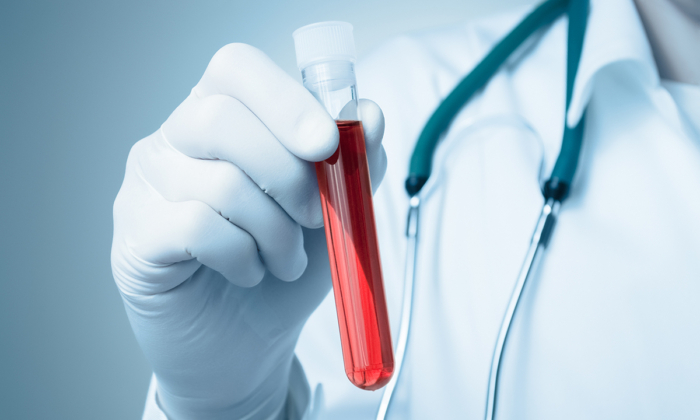 New Blood Test 91% Effective for Illness Affecting Millions