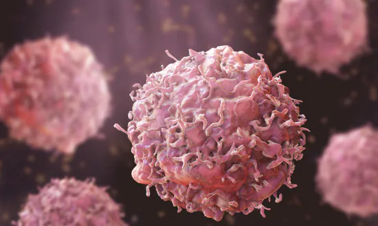 Women Younger Than 50 Are More Likely to Have Lung Cancer Than Men: Study