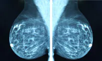 Is AI the Future of Breast Cancer Detection?