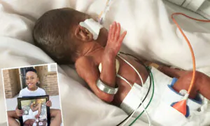Baby Born at 22 Weeks Due to Mom’s Infection Is Now Thriving—He Was So Small He Could Wear Dad’s Wedding Ring as a Bracelet