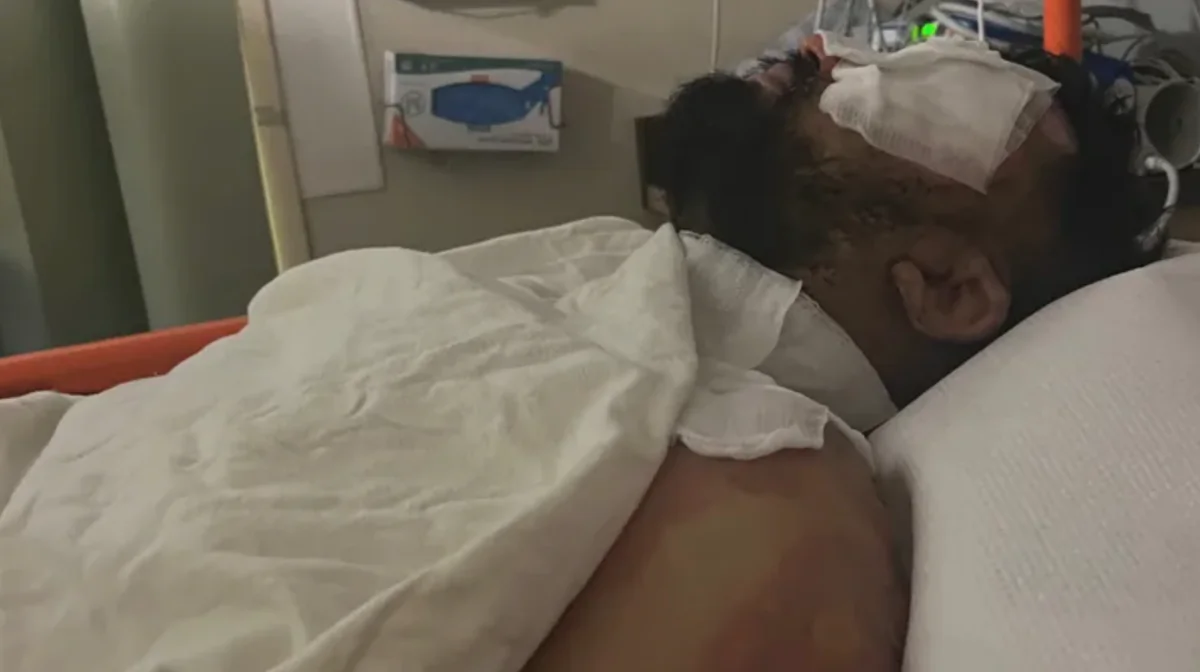 A store clerk was hospitalized after being set on fire while confronting a shoplifting suspect in a convenience store in Northern California on Sept. 22, 2023. (GoFundMe)