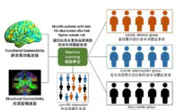 Brain Connectivity Patterns a Reliable Indication of Suicide Risk in Elderly Patients Suffering From Depression: HKU