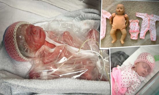 Baby Born 2 Months Early Was So Tiny She Had to Wear Doll's Clothes—But Now She's Thriving