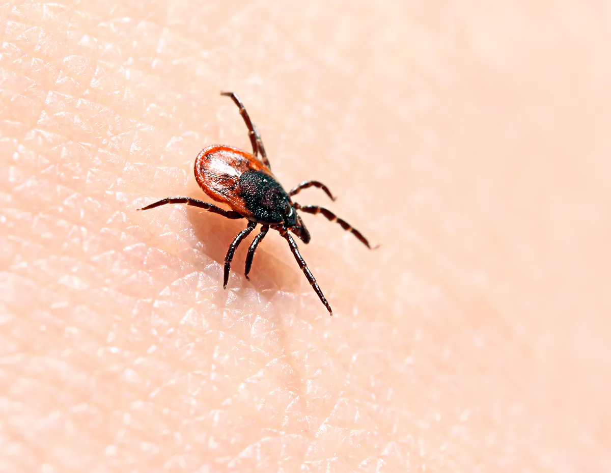 Ticks on human skin. Ixodes ricinus can transmit both bacterial and viral pathogens such as the causative agents of Lyme disease and tick-borne encephalitis. (daksel/Shutterstock)