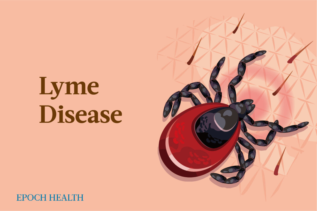 Lyme Disease: Symptoms, Causes, Treatments, and Natural Approaches