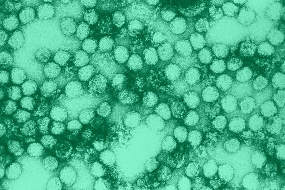 A CDC electron microscope image shows the yellow fever virus. (Erskin L. Palmer/CDC)