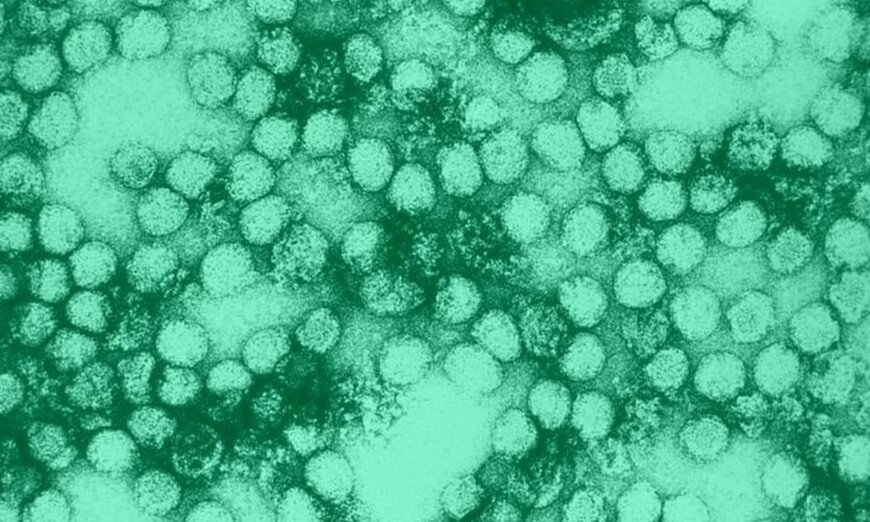 US researchers warn that a previously forgotten virus may resurface, and the country is ill-equipped to handle it.