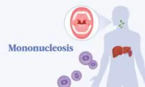 Mononucleosis: The Main Cause and 15 Signs and Symptoms