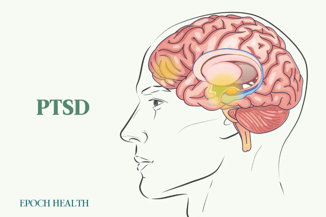 PTSD results from an abnormal physiological response to a traumatic event. (Illustrations by Shutterstock, The Epoch Times)