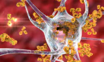 How Sugar May Be Linked to Autoimmune Diseases