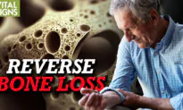 Treating Osteoporosis (Bone Loss): Medication, Micronutrients, Exercise, and Foods for Bone Health | Feat. Dr. Mohit Shukla