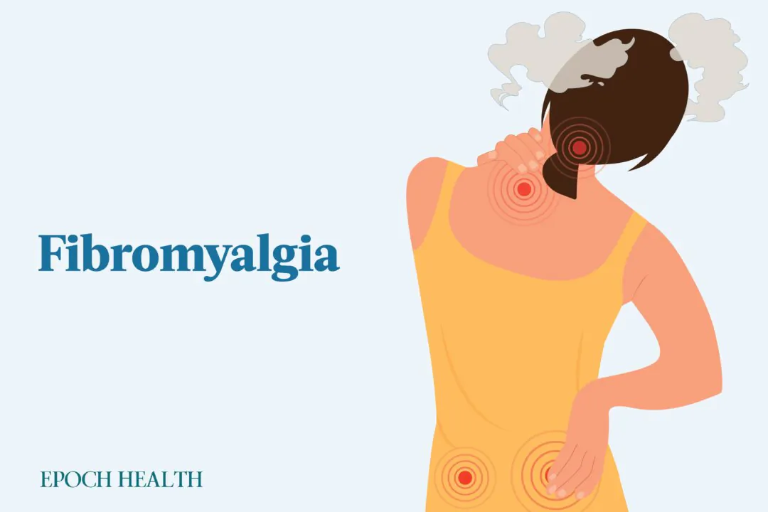 Fibromyalgia is a complex condition involving widespread, chronic pain, fatigue, and brain fog. (Illustrations by The Epoch Times, Shutterstock)