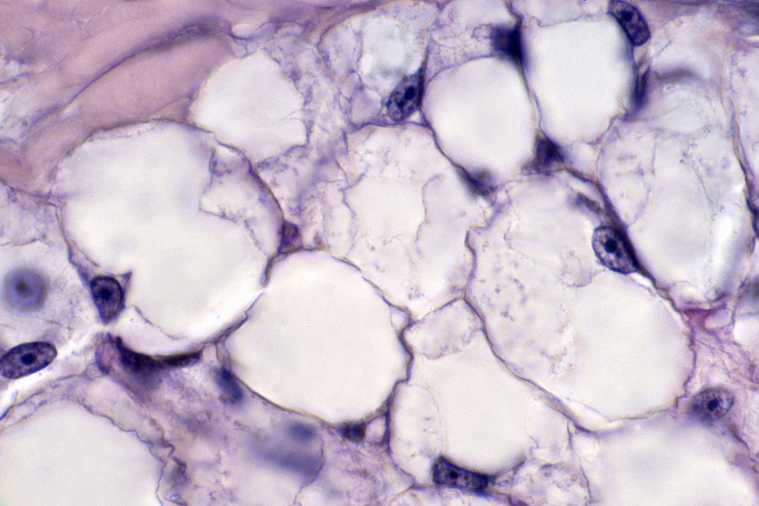 Fat cells, adipose tissue (magnification x250). (Ed Reschke/Getty Images)